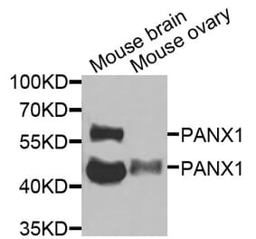 Anti-PANX1 Antibody from Bioworld Technology (BS8352) - Antibodies.com