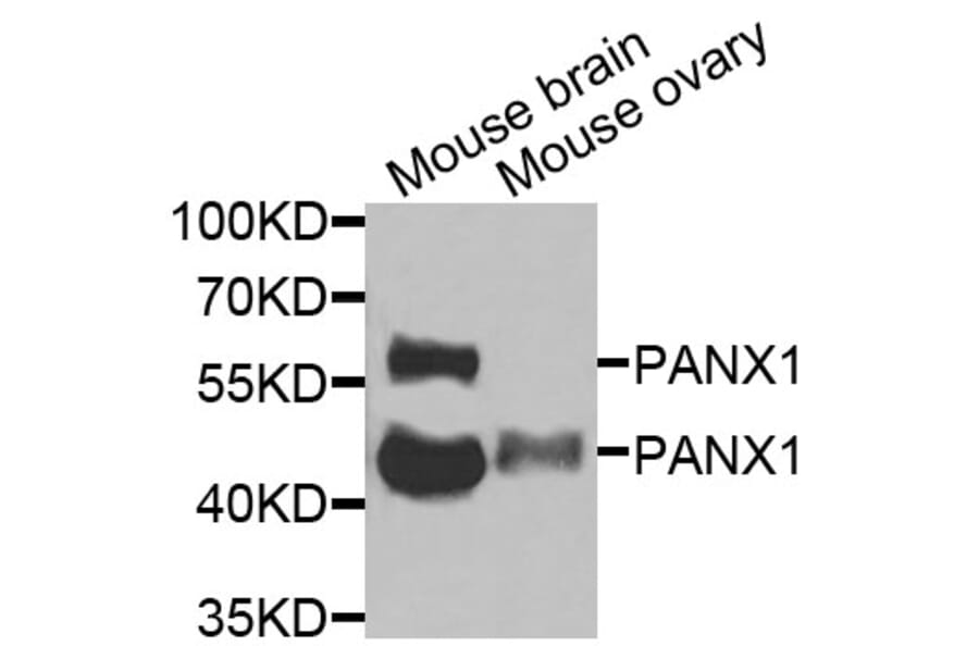 Anti-PANX1 Antibody from Bioworld Technology (BS8352) - Antibodies.com