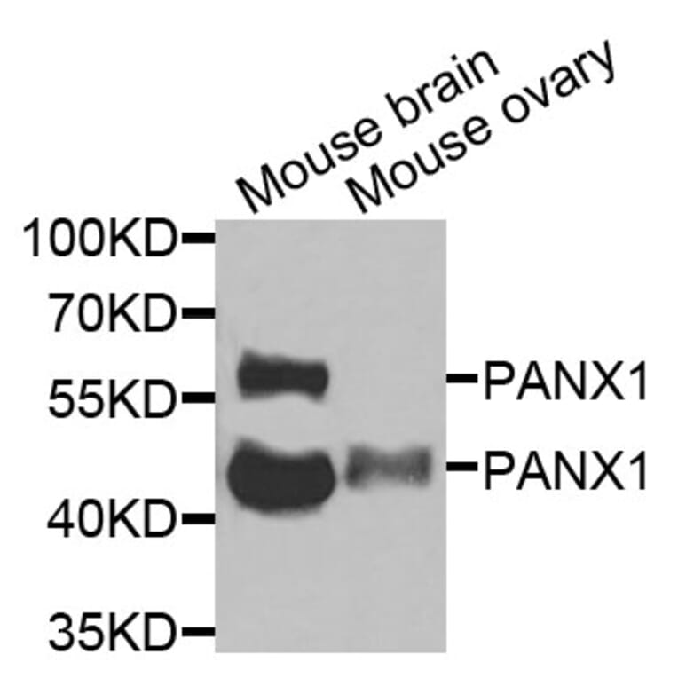 Anti-PANX1 Antibody from Bioworld Technology (BS8352) - Antibodies.com