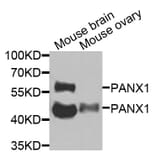 Anti-PANX1 Antibody from Bioworld Technology (BS8352) - Antibodies.com