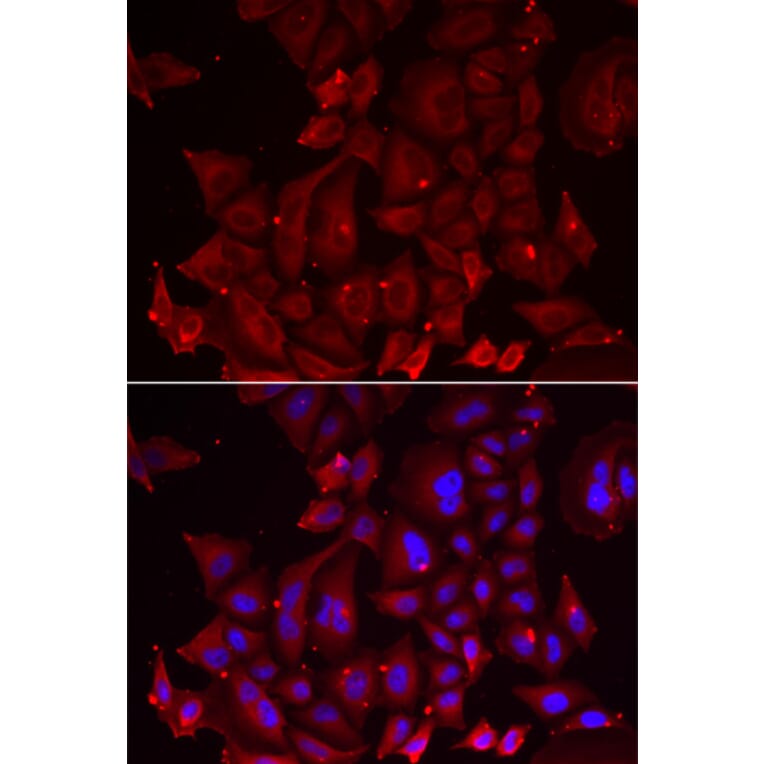 Anti-PANX1 Antibody from Bioworld Technology (BS8352) - Antibodies.com