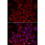 Anti-PANX1 Antibody from Bioworld Technology (BS8352) - Antibodies.com