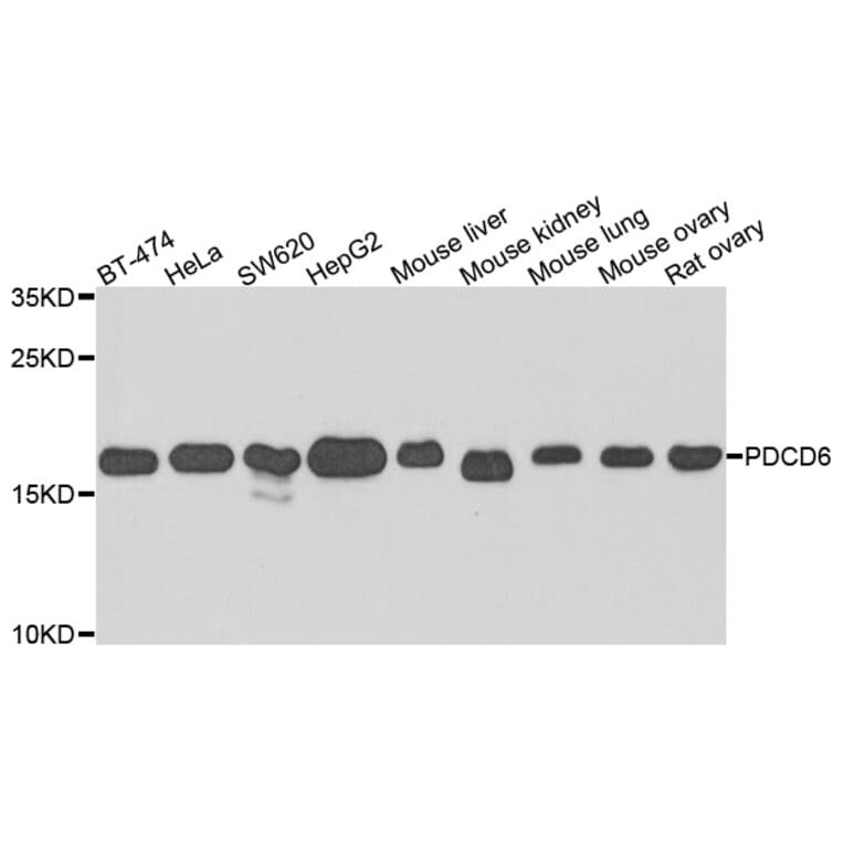 Anti-PDCD6 Antibody from Bioworld Technology (BS8354) - Antibodies.com