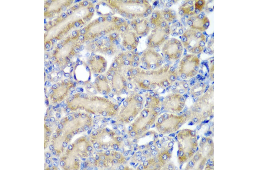 Anti-PDCD6 Antibody from Bioworld Technology (BS8354) - Antibodies.com