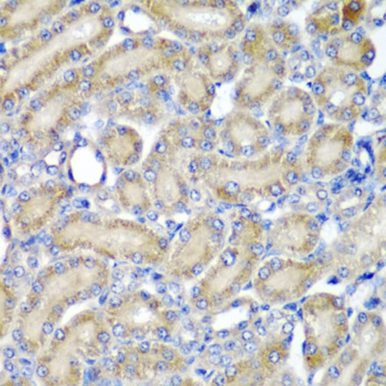 Anti-PDCD6 Antibody from Bioworld Technology (BS8354) - Antibodies.com