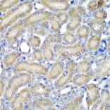 Anti-PDCD6 Antibody from Bioworld Technology (BS8354) - Antibodies.com