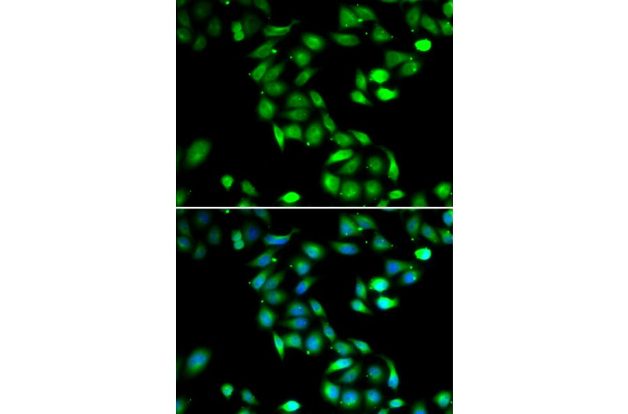 Anti-PDCD6 Antibody from Bioworld Technology (BS8354) - Antibodies.com