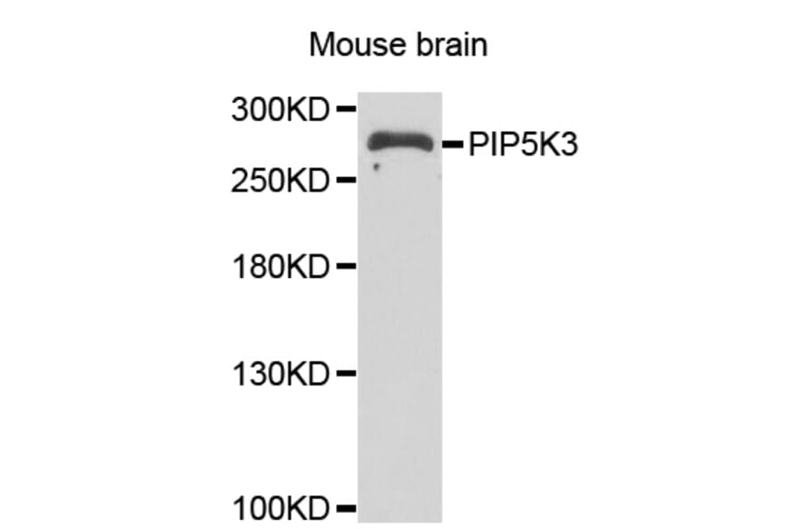 Anti-PIP5K3 Antibody from Bioworld Technology (BS8358) - Antibodies.com