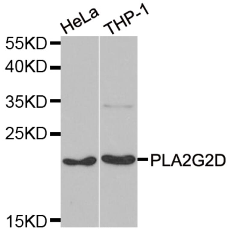 Anti-PLA2G2D Antibody from Bioworld Technology (BS8359) - Antibodies.com