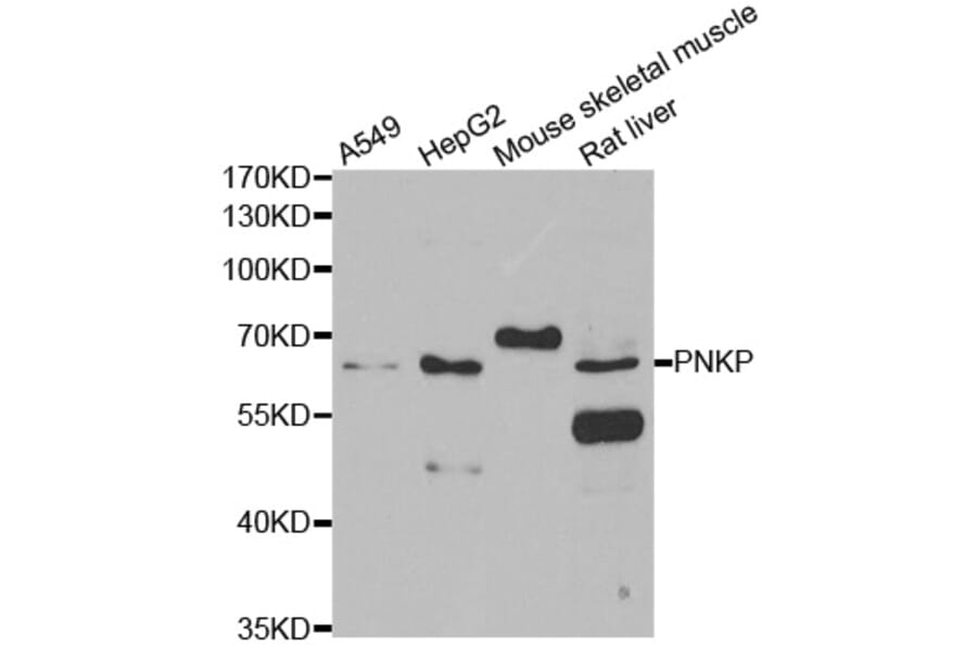 Anti-PNKP Antibody from Bioworld Technology (BS8361) - Antibodies.com