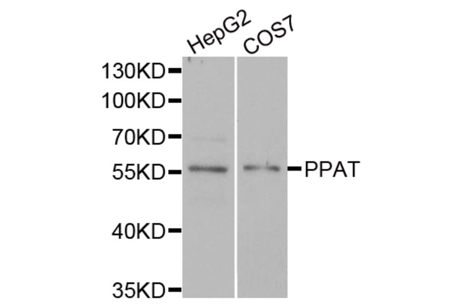 Anti-PPAT Antibody from Bioworld Technology (BS8365) - Antibodies.com