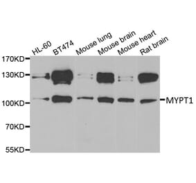 Anti-MYPT1 Antibody from Bioworld Technology (BS8367) - Antibodies.com