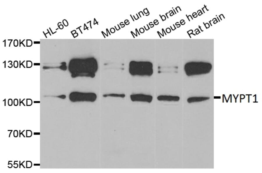 Anti-MYPT1 Antibody from Bioworld Technology (BS8367) - Antibodies.com