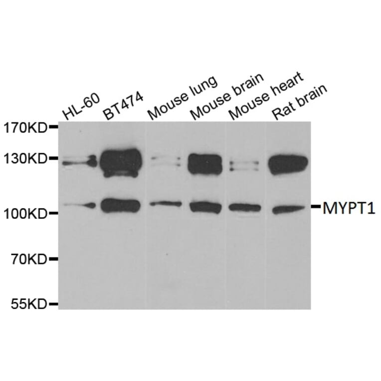 Anti-MYPT1 Antibody from Bioworld Technology (BS8367) - Antibodies.com