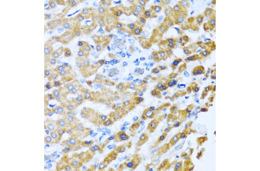 Anti-PROK2 Antibody from Bioworld Technology (BS8369) - Antibodies.com