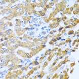 Anti-PROK2 Antibody from Bioworld Technology (BS8369) - Antibodies.com