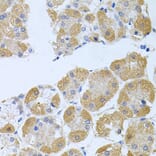 Anti-PROK2 Antibody from Bioworld Technology (BS8369) - Antibodies.com