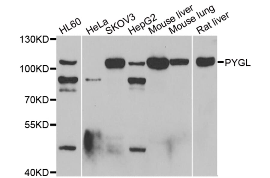 Anti-PYGL Antibody from Bioworld Technology (BS8374) - Antibodies.com