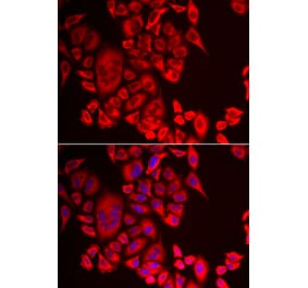 Anti-QPCT Antibody from Bioworld Technology (BS8375) - Antibodies.com