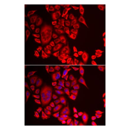 Anti-QPCT Antibody from Bioworld Technology (BS8375) - Antibodies.com