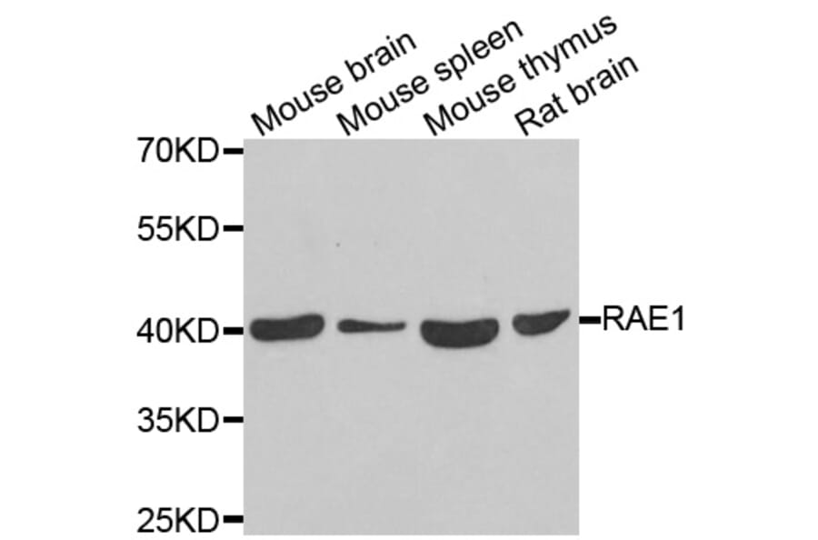 Anti-RAE1 Antibody from Bioworld Technology (BS8377) - Antibodies.com