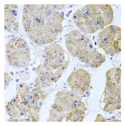 Anti-RAPSN Antibody from Bioworld Technology (BS8379) - Antibodies.com