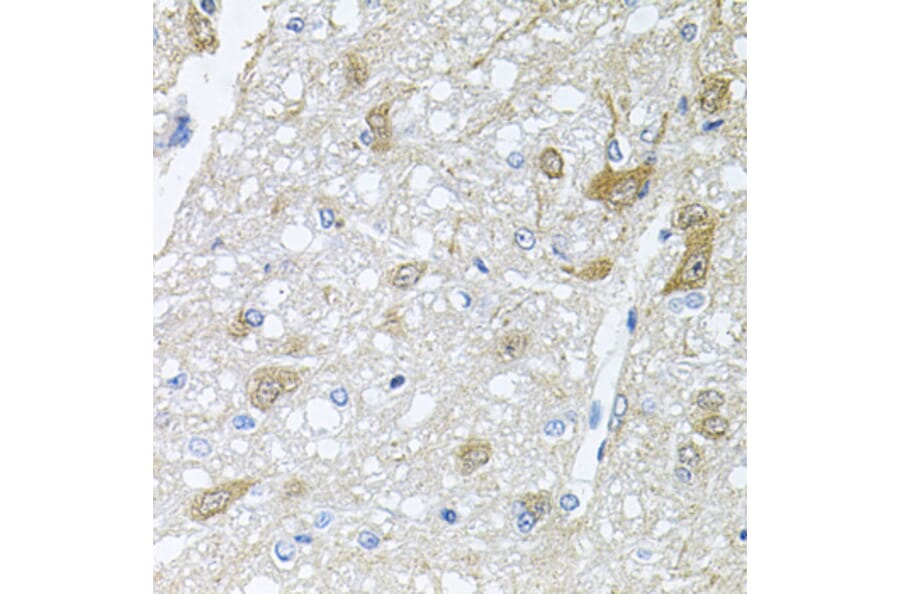 Anti-RAPSN Antibody from Bioworld Technology (BS8379) - Antibodies.com