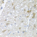 Anti-RAPSN Antibody from Bioworld Technology (BS8379) - Antibodies.com