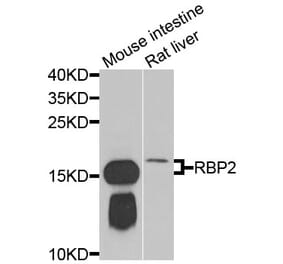 Anti-RBP2 Antibody from Bioworld Technology (BS8380) - Antibodies.com