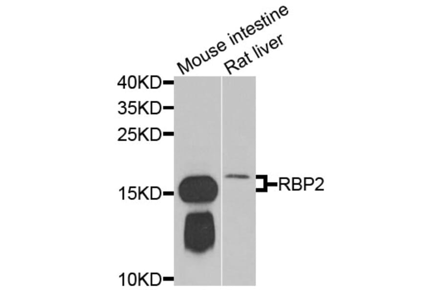 Anti-RBP2 Antibody from Bioworld Technology (BS8380) - Antibodies.com
