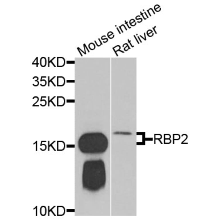 Anti-RBP2 Antibody from Bioworld Technology (BS8380) - Antibodies.com