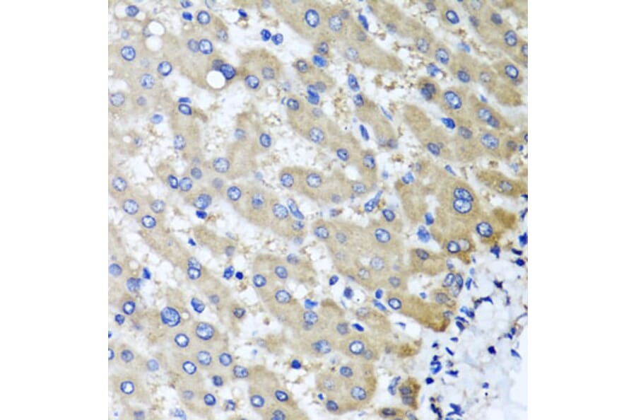 Anti-RBP2 Antibody from Bioworld Technology (BS8380) - Antibodies.com