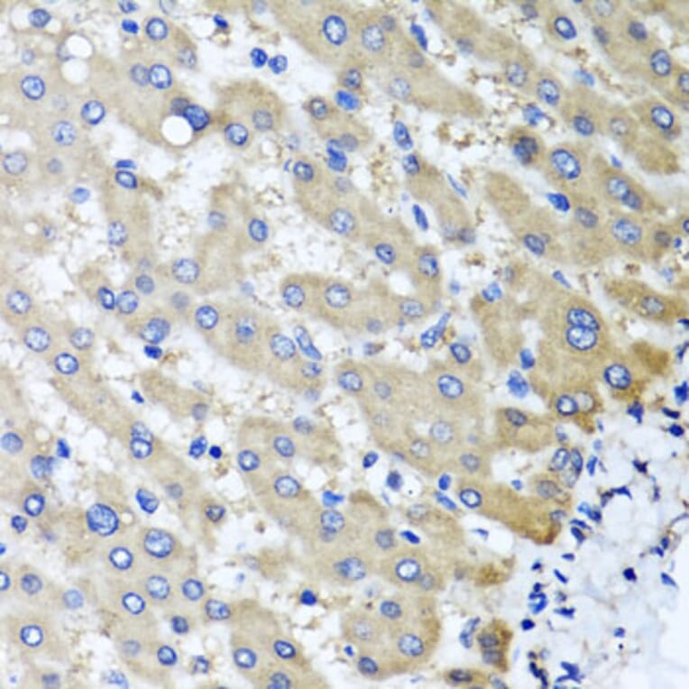 Anti-RBP2 Antibody from Bioworld Technology (BS8380) - Antibodies.com