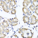 Anti-RBP2 Antibody from Bioworld Technology (BS8380) - Antibodies.com