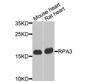 Anti-RPA3 Antibody from Bioworld Technology (BS8384) - Antibodies.com