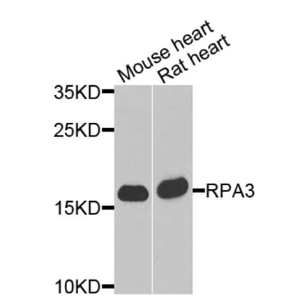 Anti-RPA3 Antibody from Bioworld Technology (BS8384) - Antibodies.com