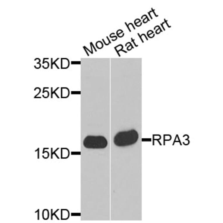 Anti-RPA3 Antibody from Bioworld Technology (BS8384) - Antibodies.com