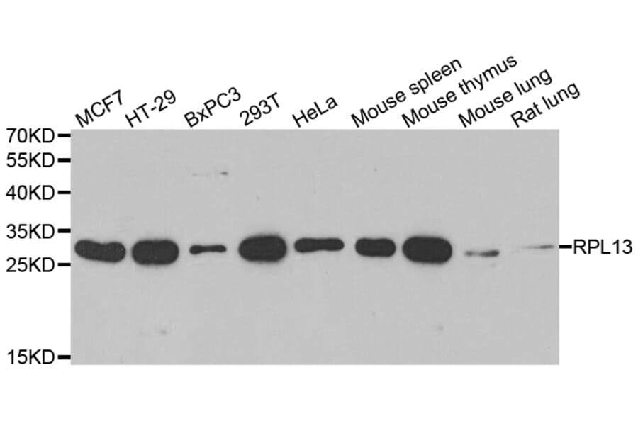Anti-RPL13 Antibody from Bioworld Technology (BS8386) - Antibodies.com