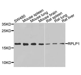 Anti-RPLP1 Antibody from Bioworld Technology (BS8388) - Antibodies.com