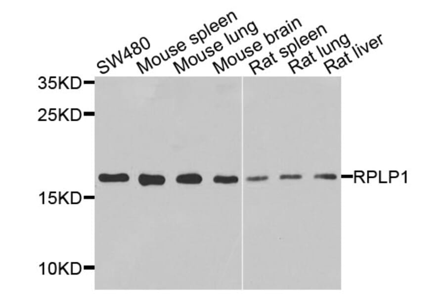 Anti-RPLP1 Antibody from Bioworld Technology (BS8388) - Antibodies.com