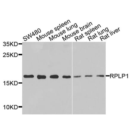 Anti-RPLP1 Antibody from Bioworld Technology (BS8388) - Antibodies.com