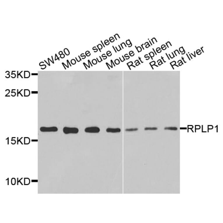 Anti-RPLP1 Antibody from Bioworld Technology (BS8388) - Antibodies.com