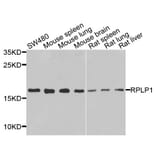 Anti-RPLP1 Antibody from Bioworld Technology (BS8388) - Antibodies.com
