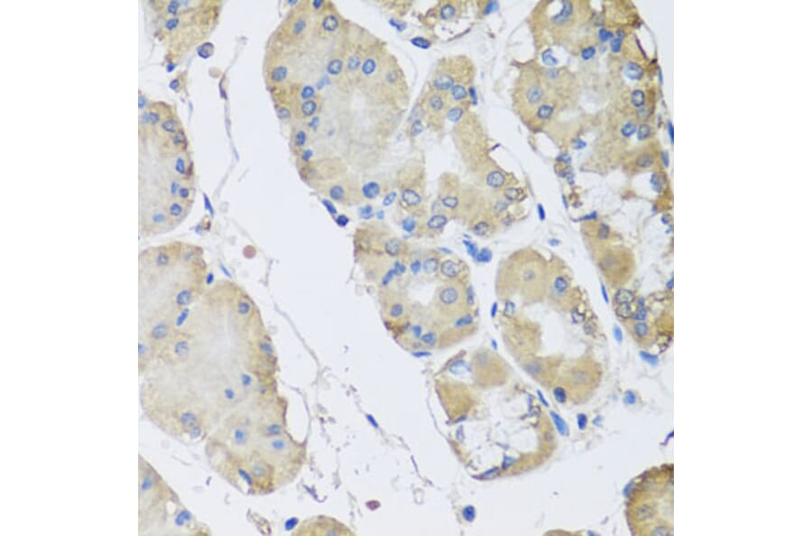 Anti-RPLP1 Antibody from Bioworld Technology (BS8388) - Antibodies.com