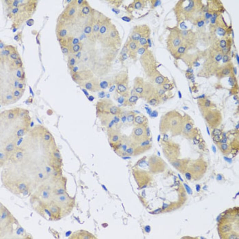 Anti-RPLP1 Antibody from Bioworld Technology (BS8388) - Antibodies.com