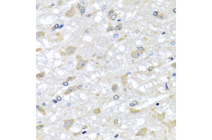 Anti-RPLP1 Antibody from Bioworld Technology (BS8388) - Antibodies.com
