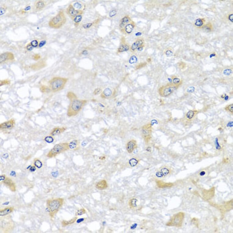 Anti-RPLP1 Antibody from Bioworld Technology (BS8388) - Antibodies.com
