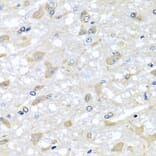 Anti-RPLP1 Antibody from Bioworld Technology (BS8388) - Antibodies.com