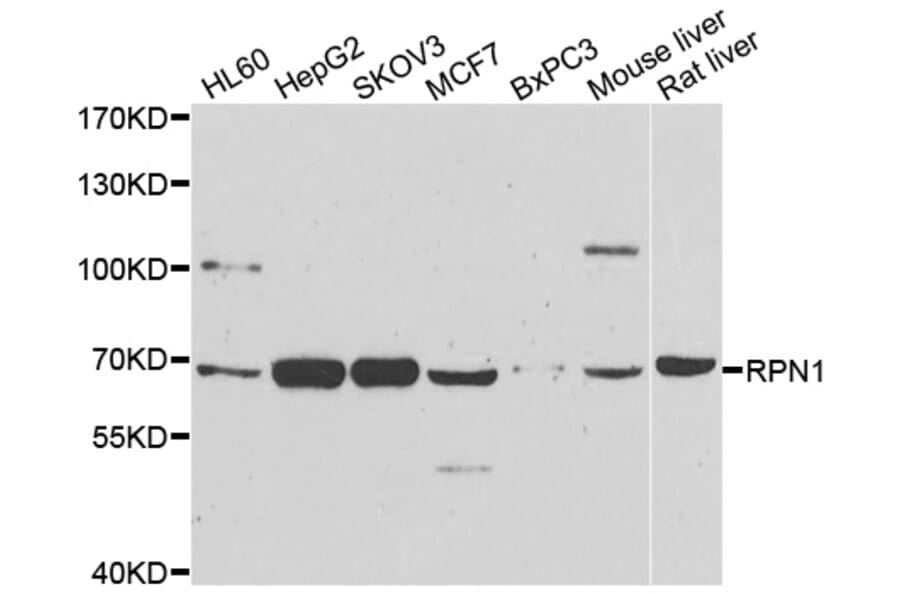 Anti-RPN1 Antibody from Bioworld Technology (BS8389) - Antibodies.com