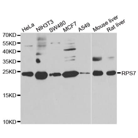 Anti-RPS7 Antibody from Bioworld Technology (BS8391) - Antibodies.com